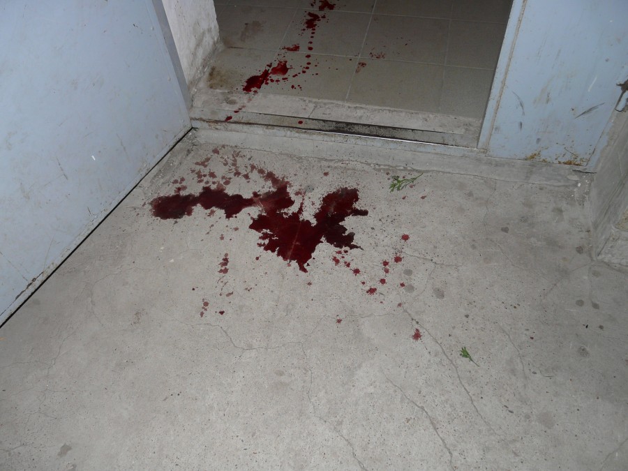 В Киеве в закрытом туалете хостела нашли труп мужчины с разбитой головой