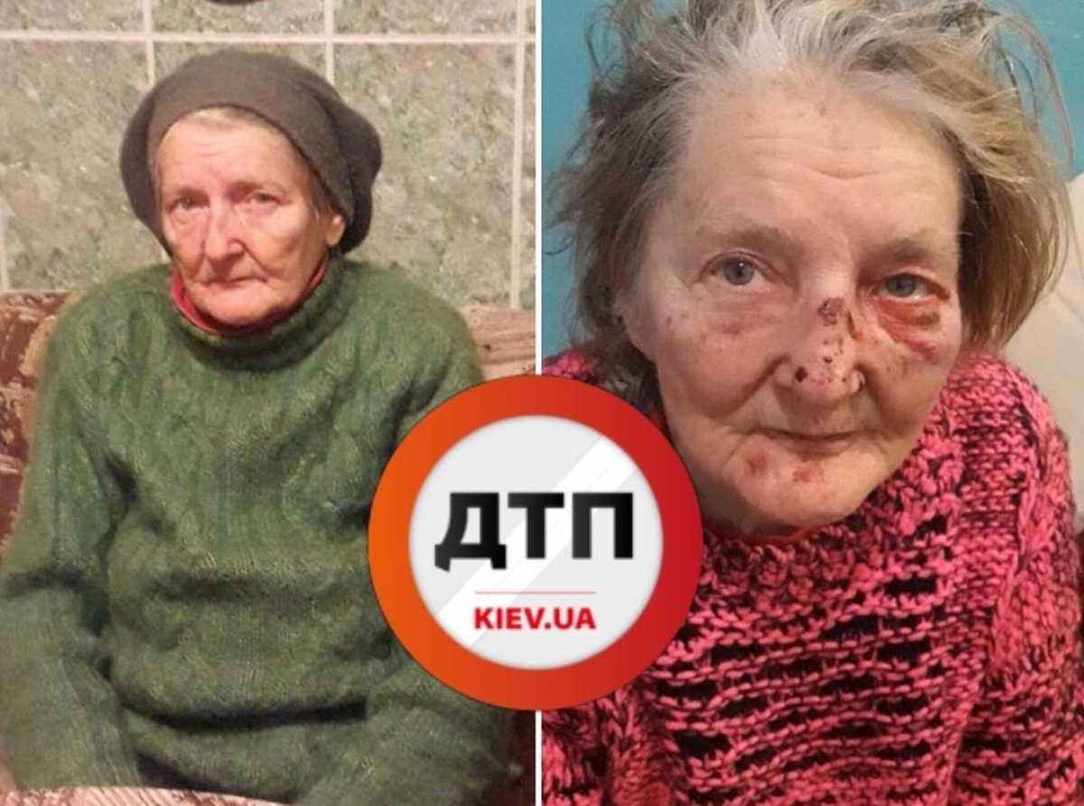 Пропавшая 78-летняя женщина, которая два дня назад ушла гулять с собакой в Святошинском районе Киева, нашлась избитой в лесу Ирпеня