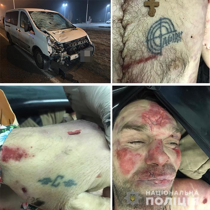 Под Днепром Citroën насмерть сбил мужчину: полиция просит опознать