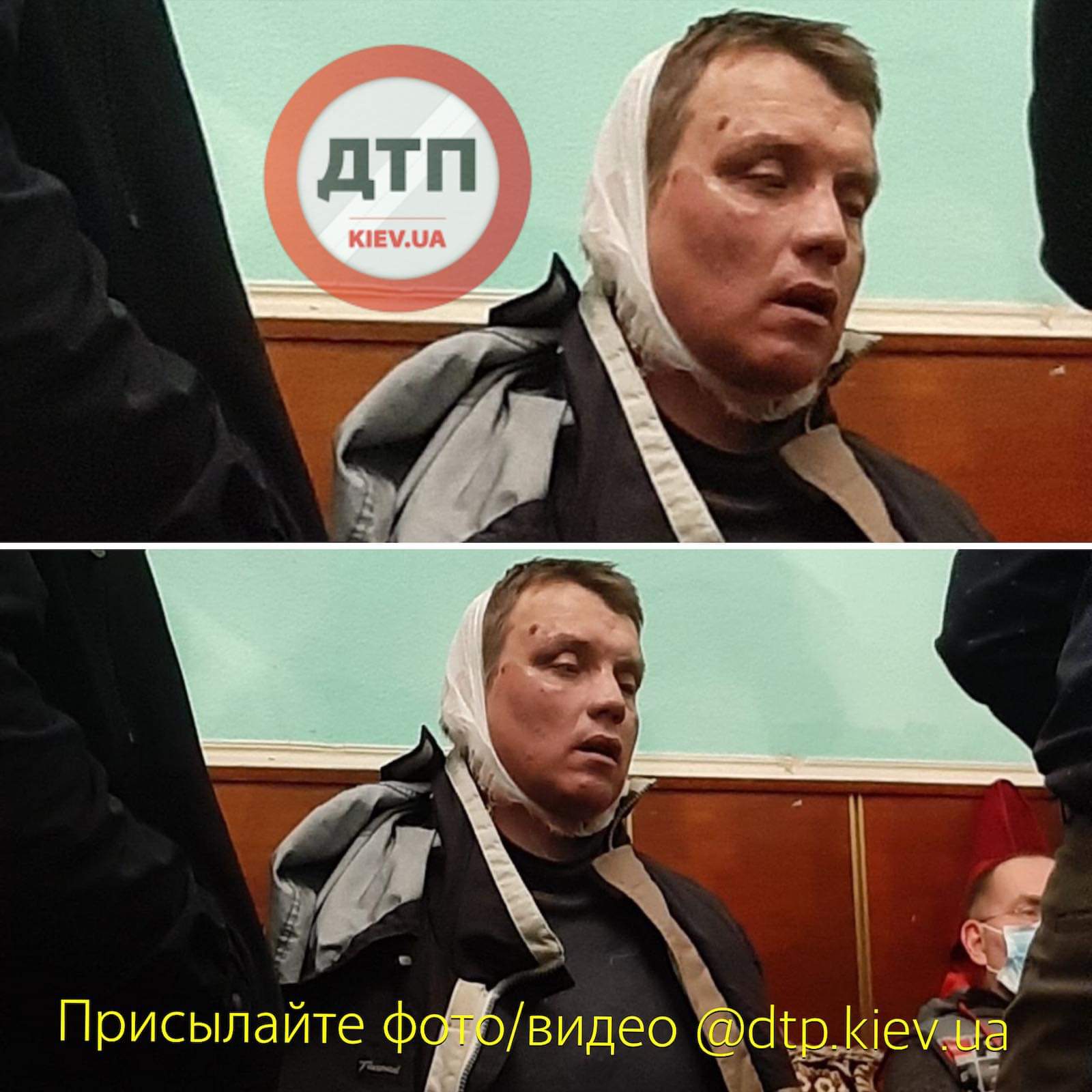 У Києві на вулиці Бальзака чоловік отримав 6 ножових поранень в шию та обличчя